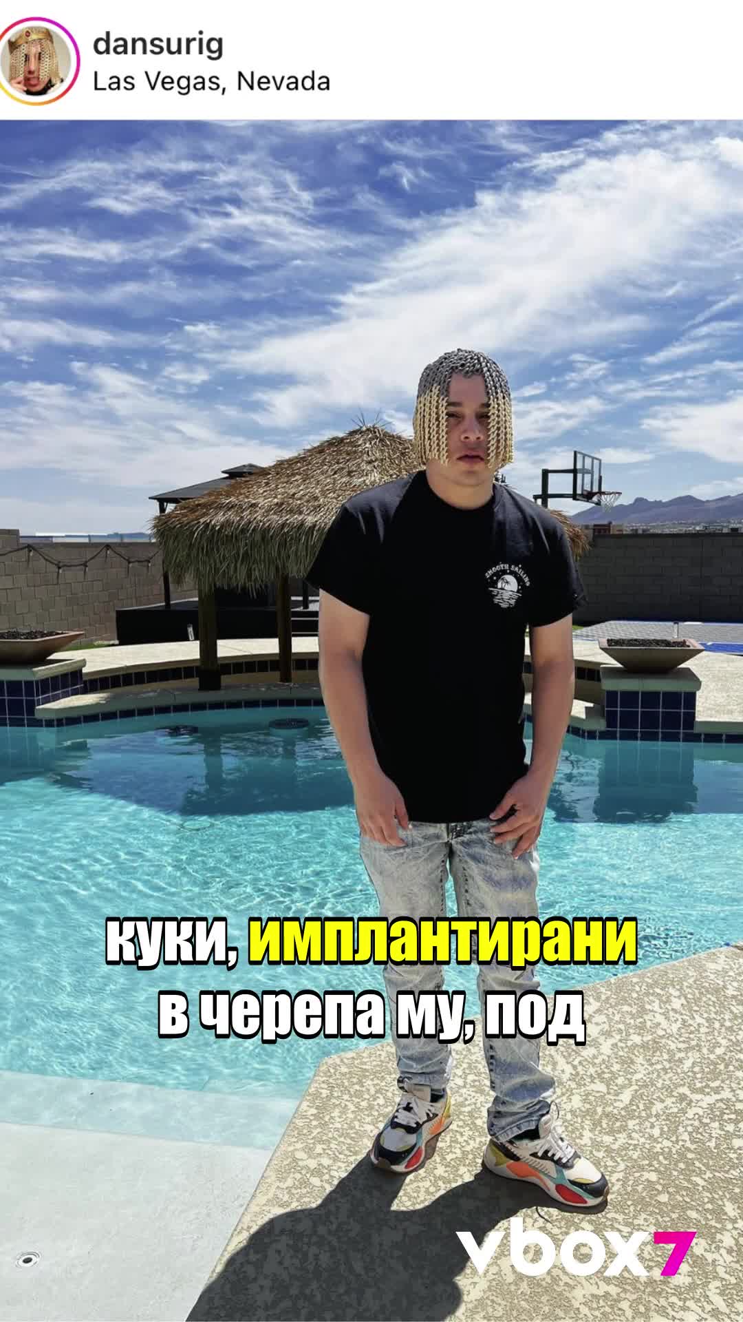 Рапър си присади метални вериги вместо коса?