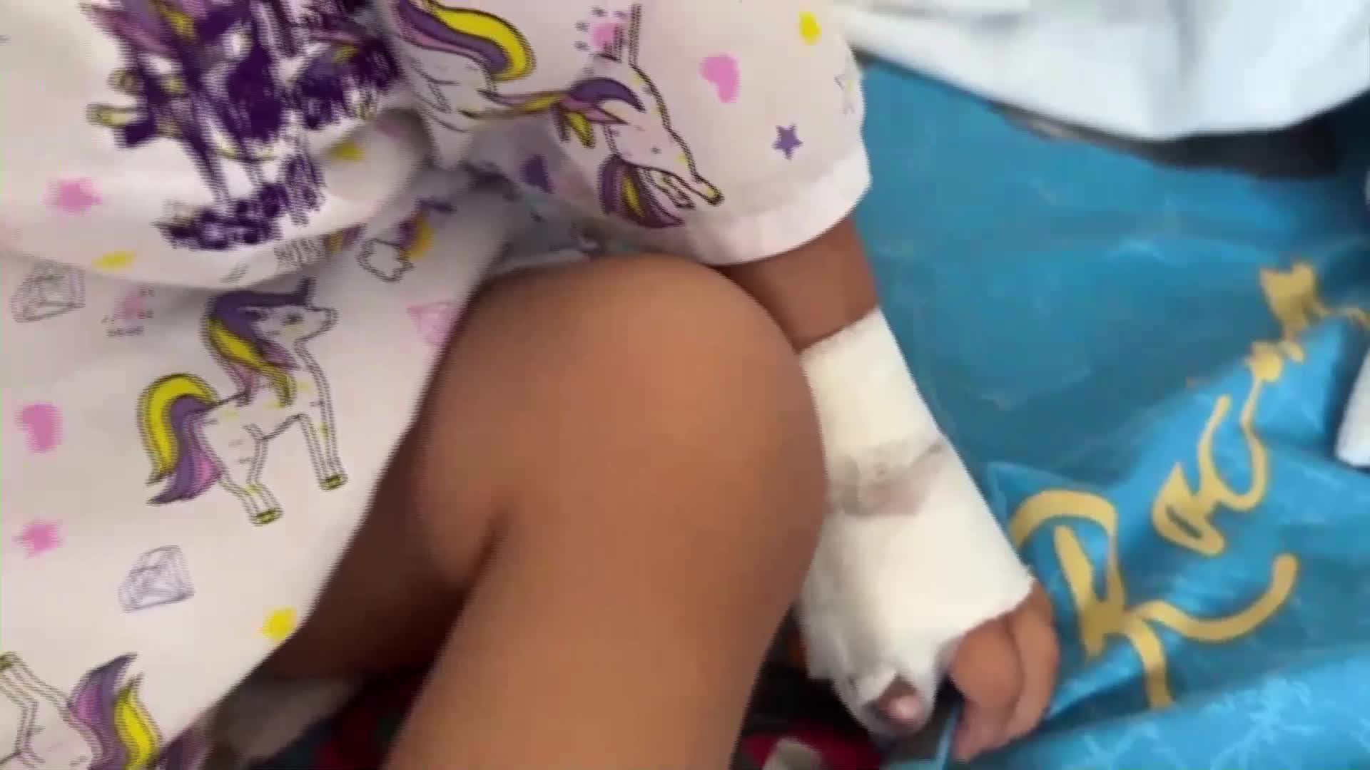 Дете в Перу погълна осем игли (ВИДЕО)