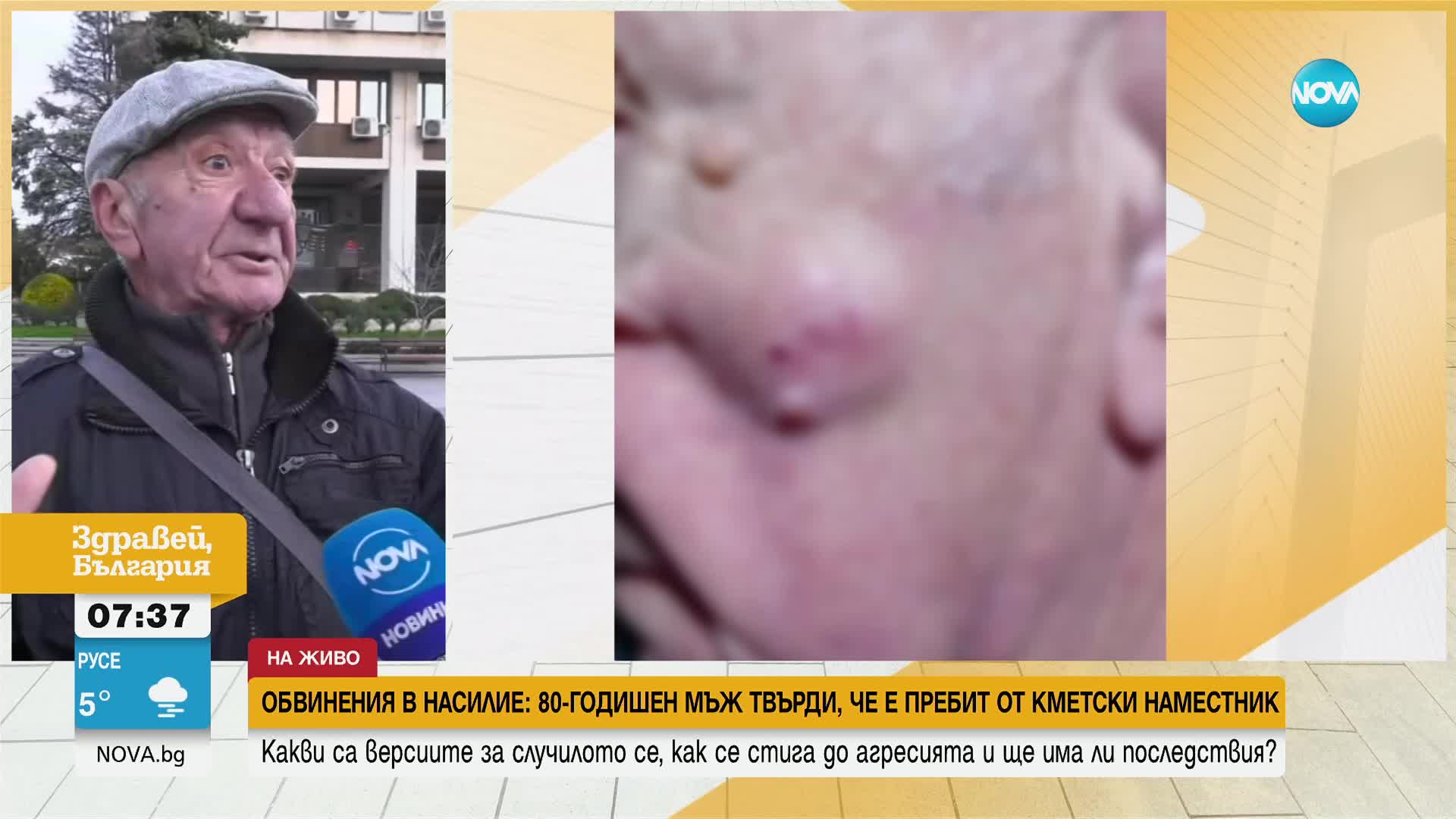 Обвинения в насилие: 80-годишен мъж твърди, че е пребит от кметски наместник
