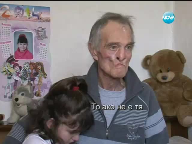 Човекът без лице пак е изправен пред ударите съдбата