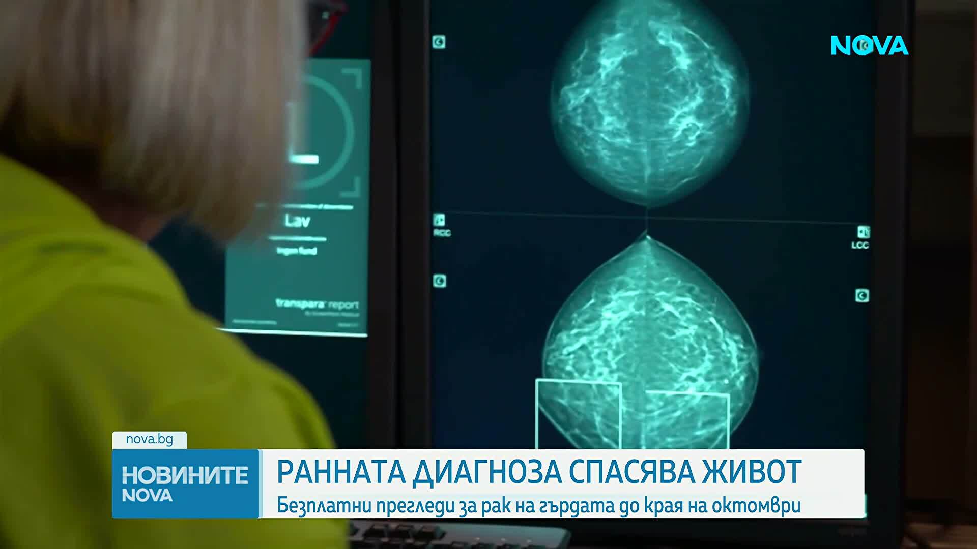 Ранната диагноза спасява живот: Безплатни прегледи за рак на гърдата до края на октомври