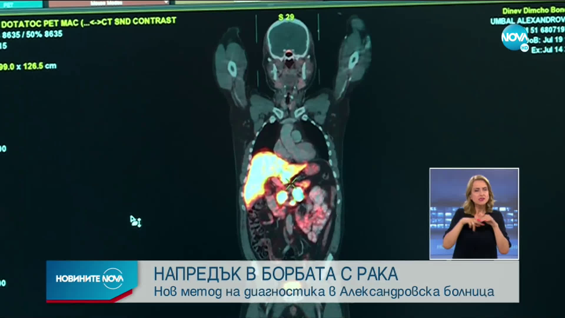 В Александровска болница използват нов метод за диагностика на рак