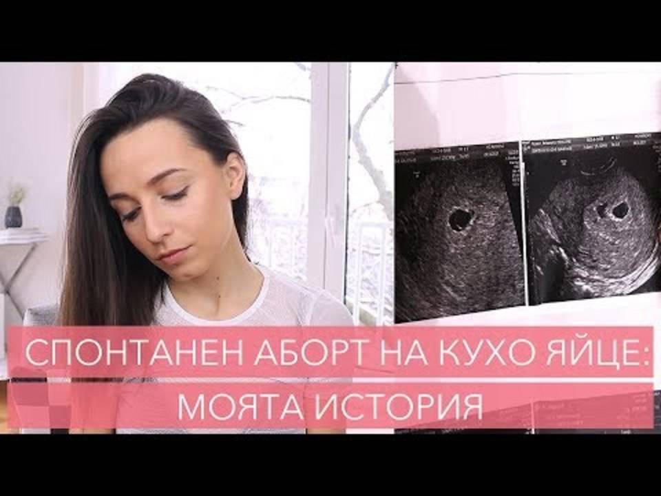 СПОНТАНЕН АБОРТ НА КУХО ЯЙЦЕ: МОЯТА ИСТОРИЯ